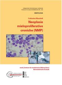Neoplasie mieloproliferative croniche (NMP) ed. 2019